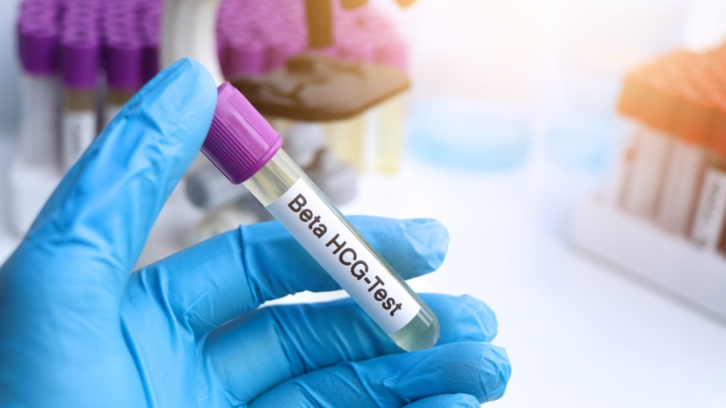Laboratorijski tehničar drži epruvetu za beta hCG test