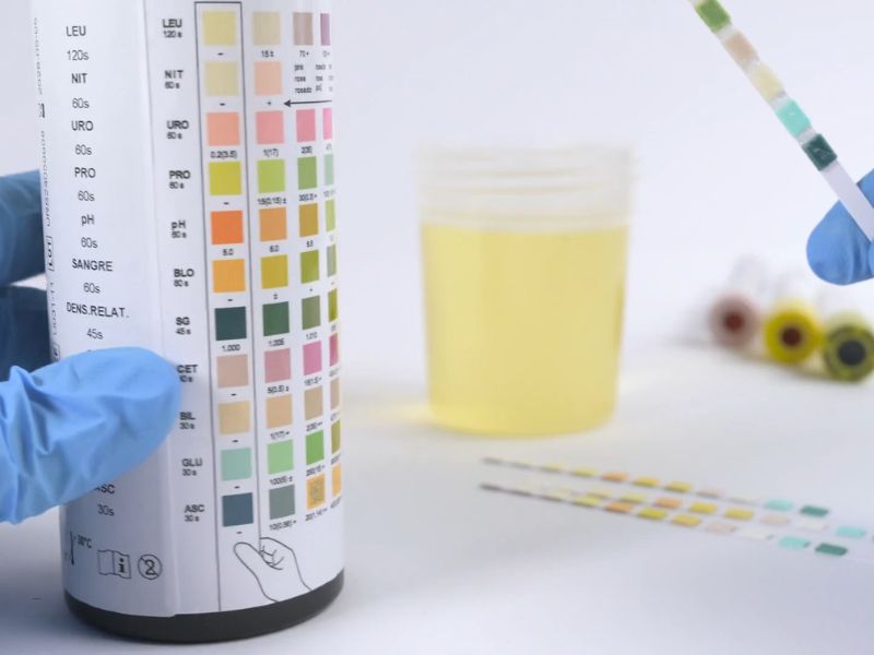 Prikaz testa za urinarnu infekciju