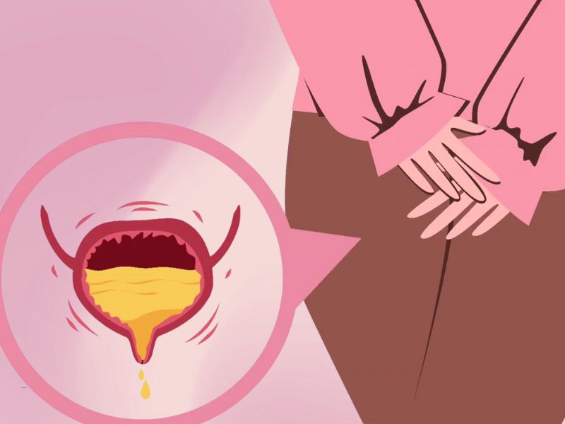 prikaz urinarne infekcije kdo žena na roze pozadini